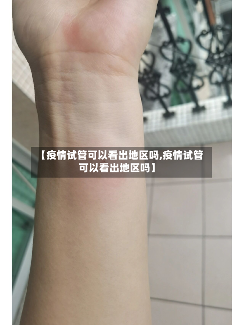 【疫情试管可以看出地区吗,疫情试管可以看出地区吗】