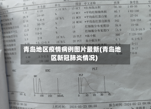 青岛地区疫情病例图片最新(青岛地区新冠肺炎情况)