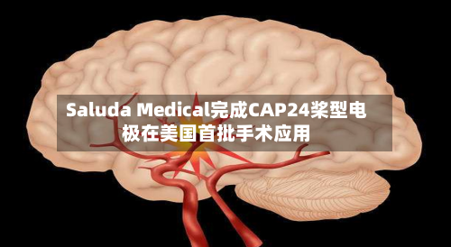 Saluda Medical完成CAP24桨型电极在美国首批手术应用-第3张图片