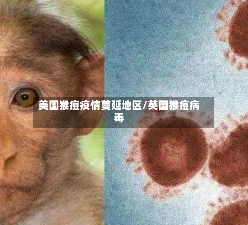 美国猴痘疫情蔓延地区/英国猴痘病毒