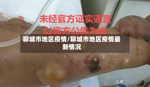 聊城市地区疫情/聊城市地区疫情最新情况