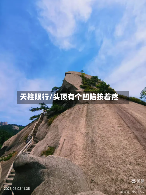 天柱限行/头顶有个凹陷按着疼-第2张图片